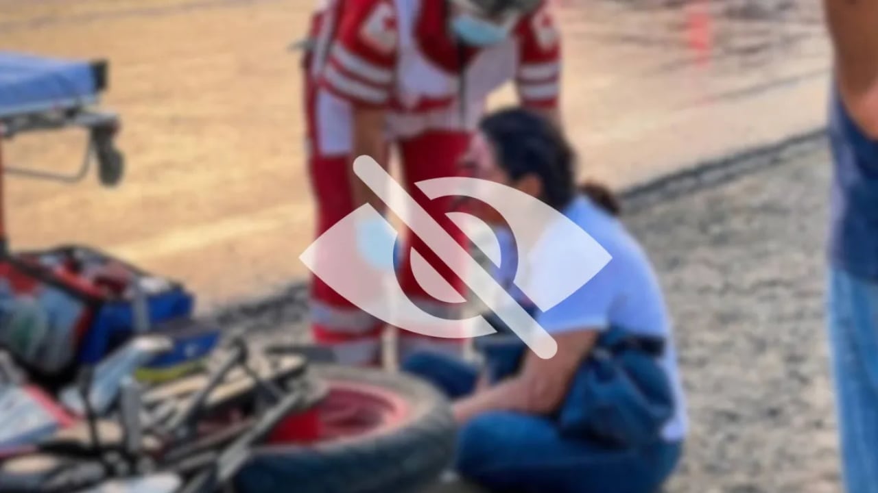 A una joven de 24 años se le desprendió el rostro en un accidente en Veracruz, ¿cómo pasó?